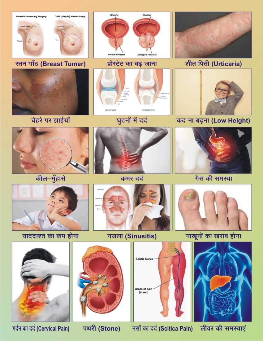 Specialized Treatments